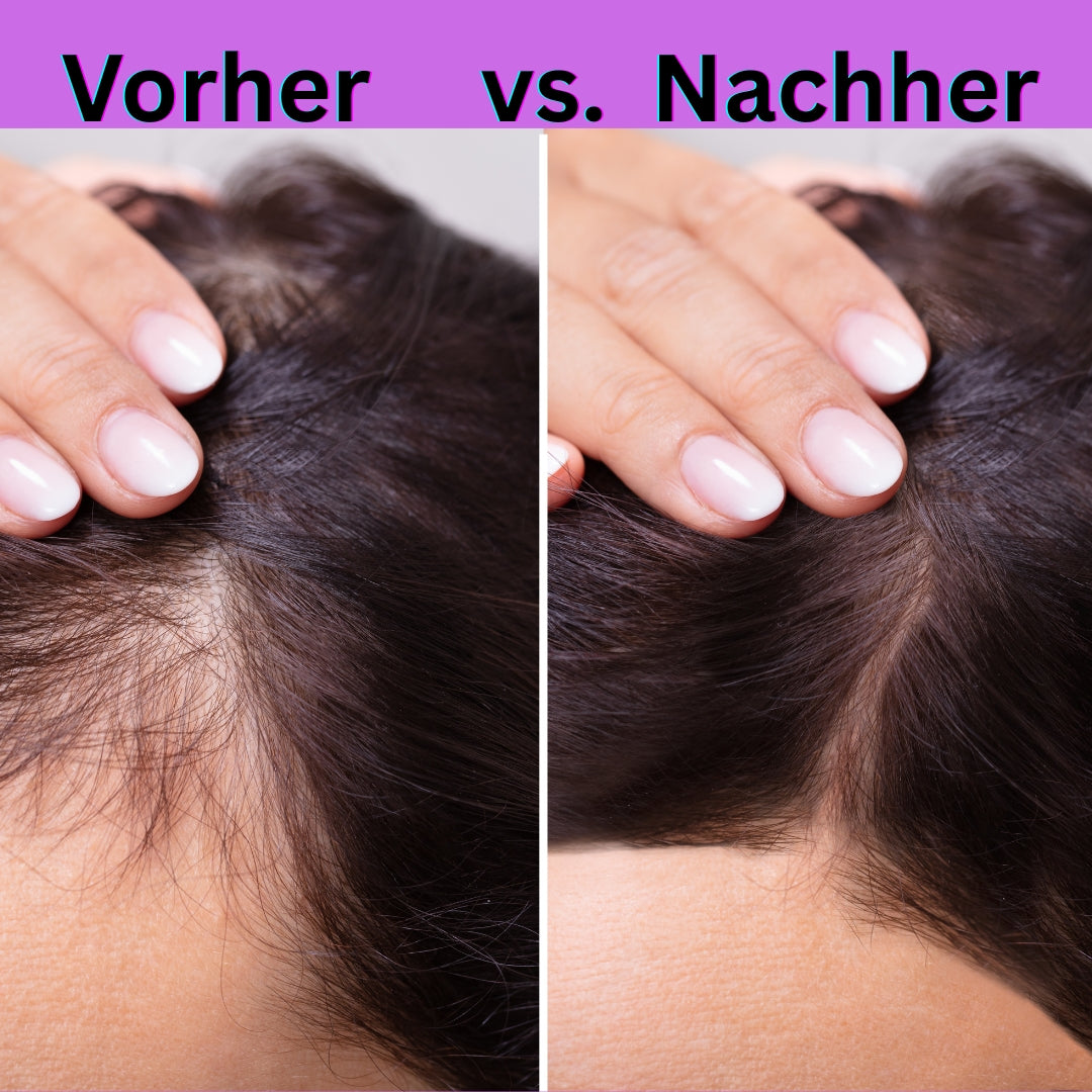 Biotin + Silizium + Vitamin C für Haut, Haare & Nägel – Bambus, Hirse & Brennnessel Formel für Wachstum & Schönheit von innen  Ohne Zucker, Clean Label, Made in Germany 🇩🇪 – NUTRI-LEAF